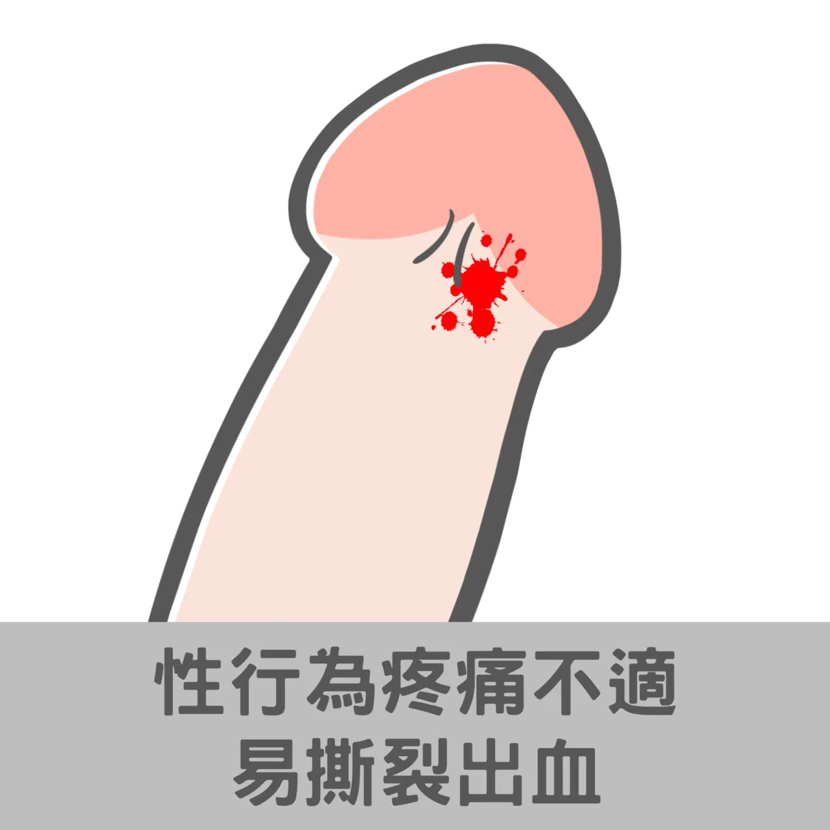 性行為疼痛不適易撕裂出血
