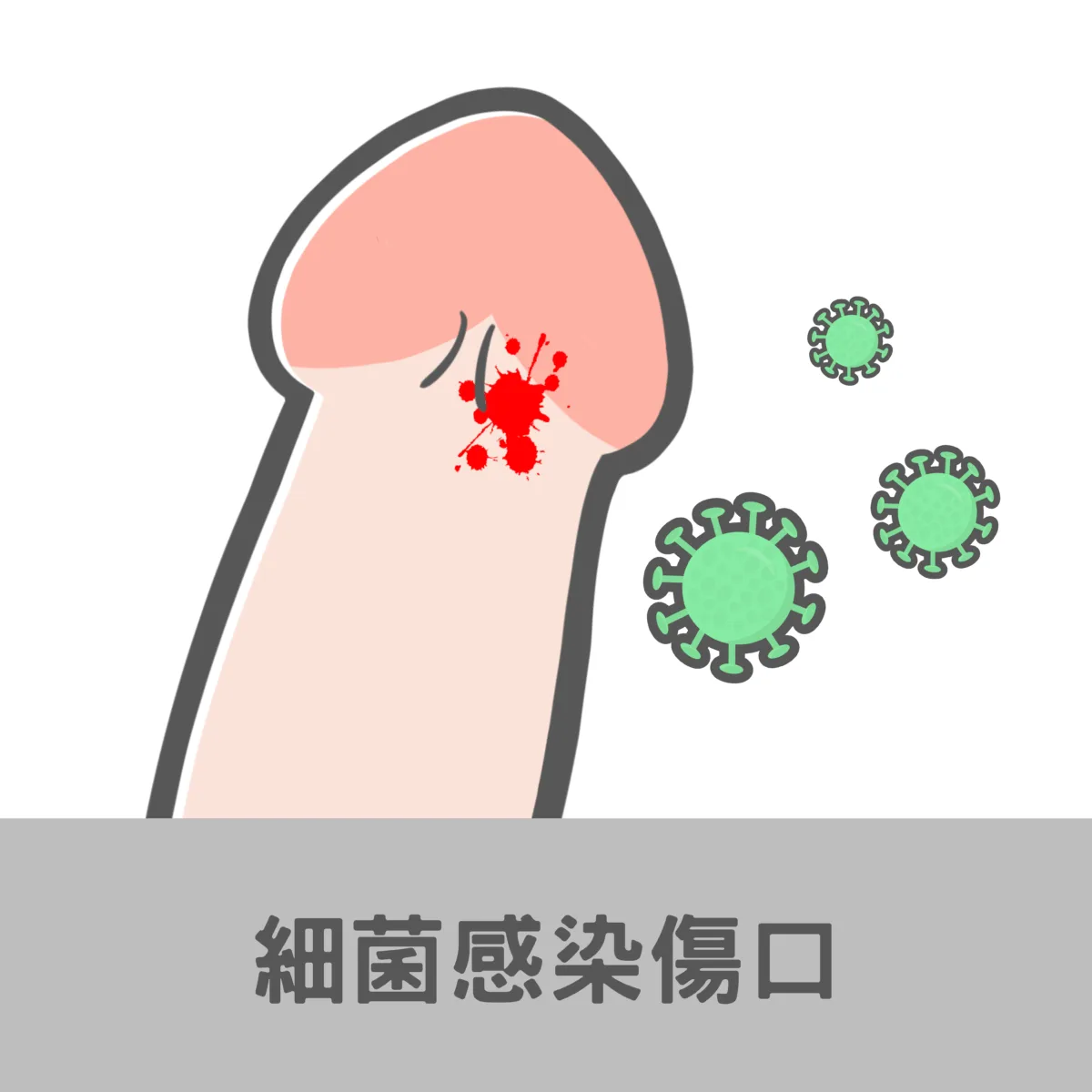 細菌感染傷口